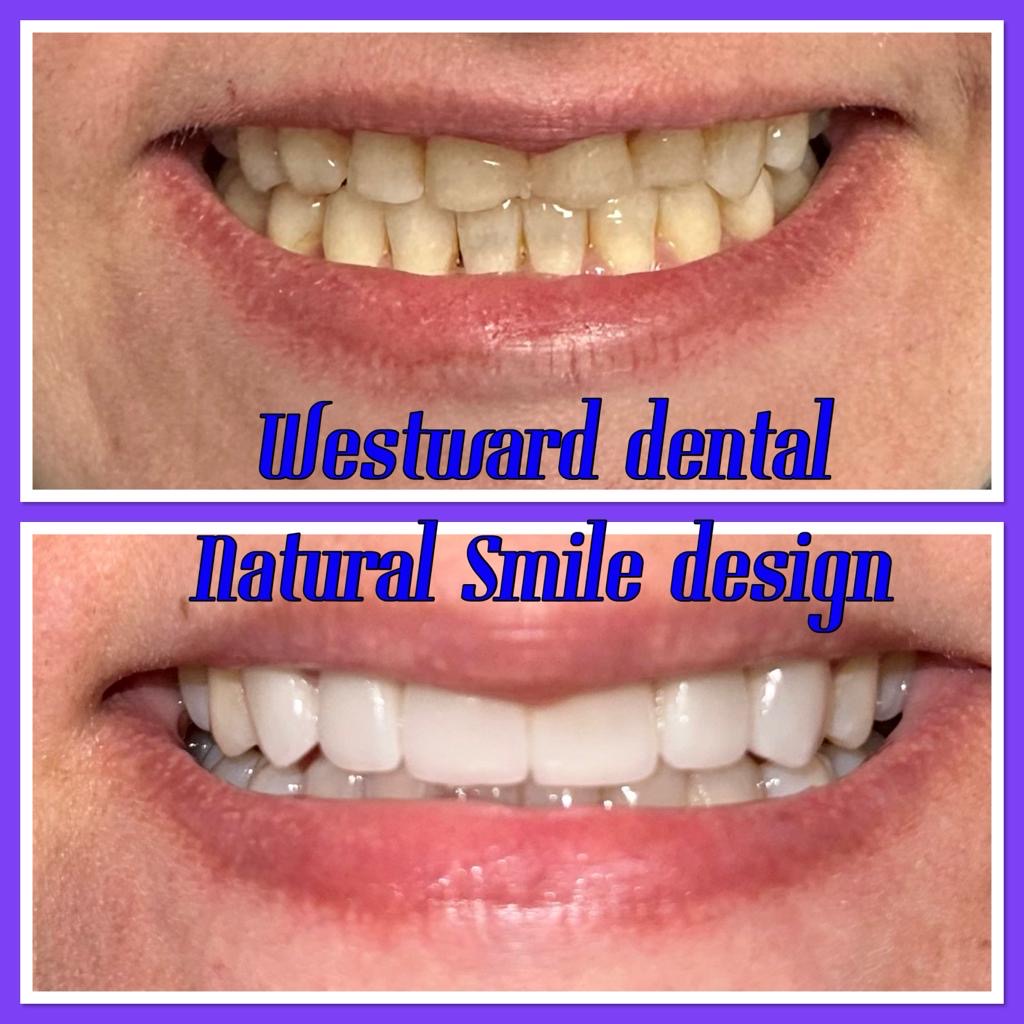 Westward Dental